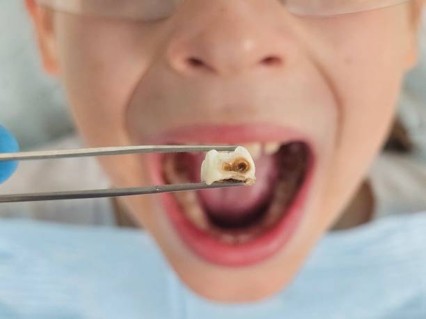 Best Dentist for Tooth Abscess  in Ho Ho Kus, NJ